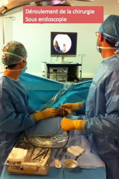 operation canal carpien endoscopie combien de temps dr falcone chirurgien orthopedique paris chirurgie main paris