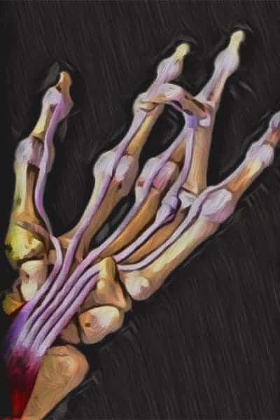 schema doigt a ressaut causes symptomes operation de la main chirurgien orthopediste main poignet paris docteur marc olivier falcone paris