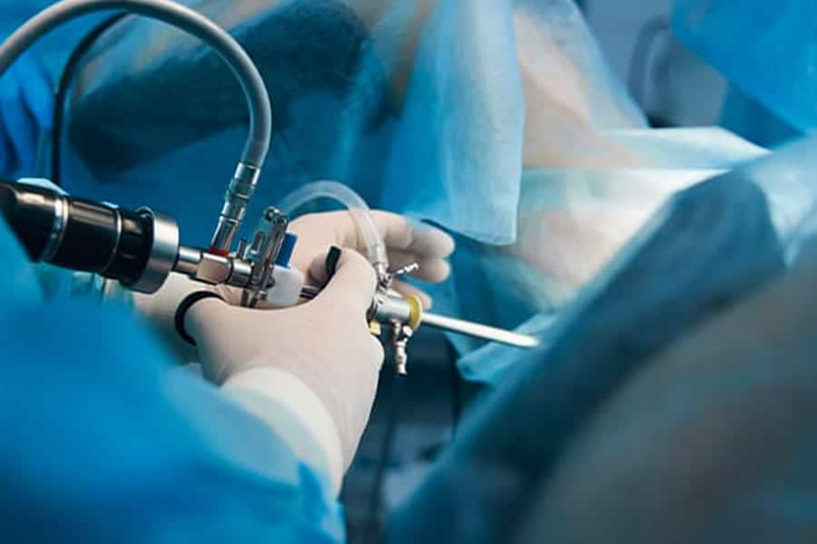 operation latarjet ou bankart douleur chirurgie de l epaule dr falcone chirurgien specialiste epaule paris