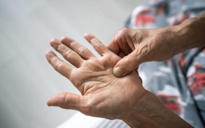 Qu&rsquo;est-ce que la maladie de Dupuytren ?