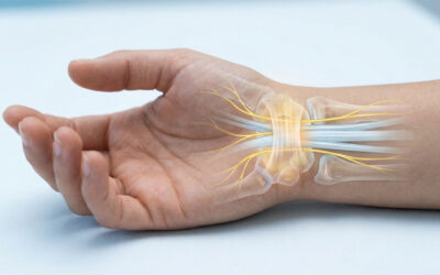 Tout comprendre sur les syndromes canalaires main poignet