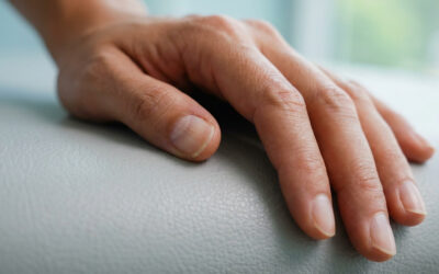 Ongle déformé : quand consulter un chirurgien de la main ?